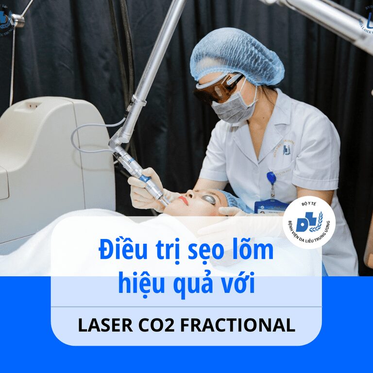 trị mụn tại bệnh viện da liễu