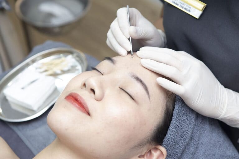 spa trị mụn ở cần thơ tốt