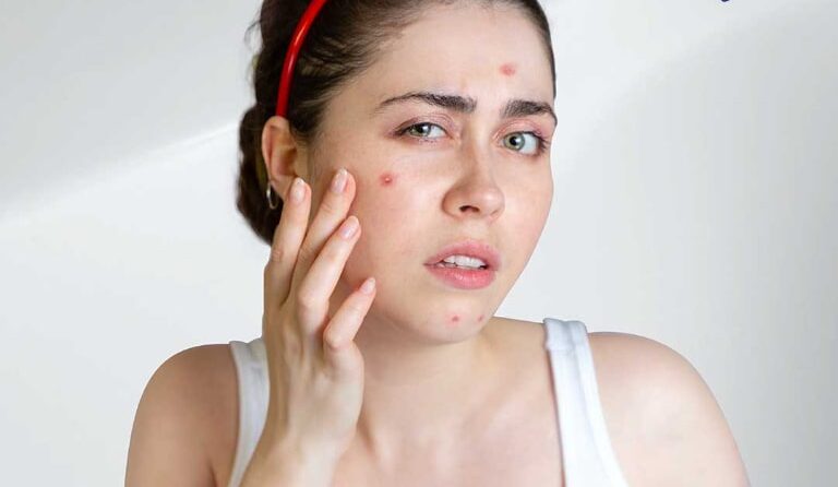 Spa trị mun ở Vũng Tàu