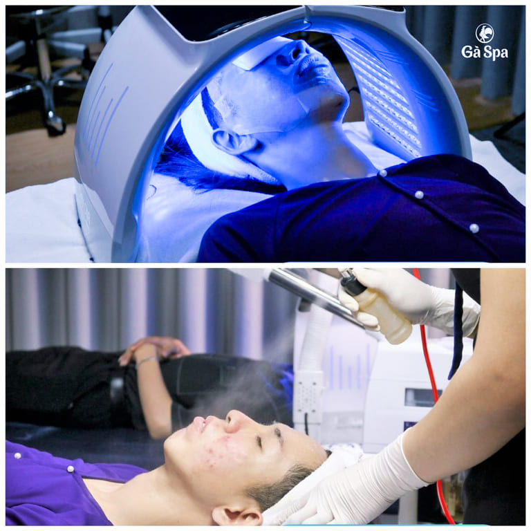 spa trị mụn quận 12 uy tín hàng đầu