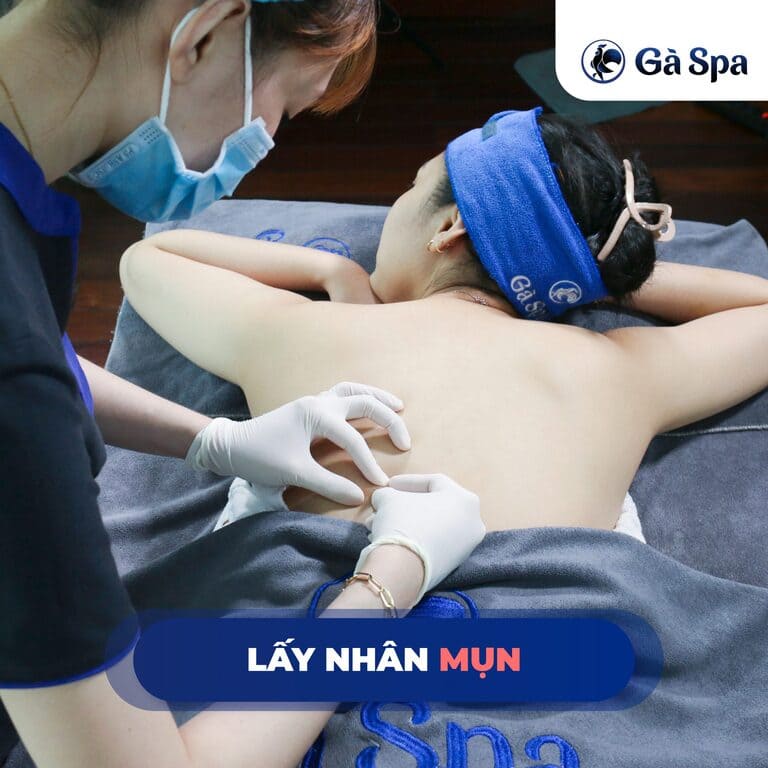 trị mụn lưng spa tốt