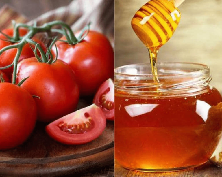 trị mụn tại nhà bằng cà chua