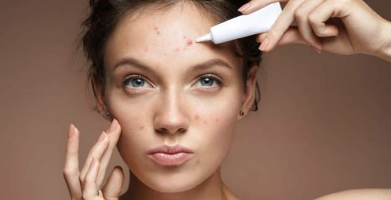 trị mụn bằng hồ nước