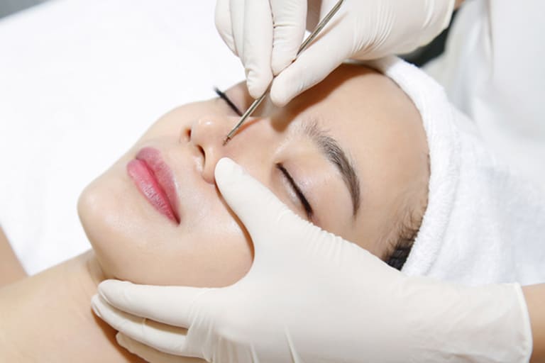 nặn mụn bị thâm phải làm sao