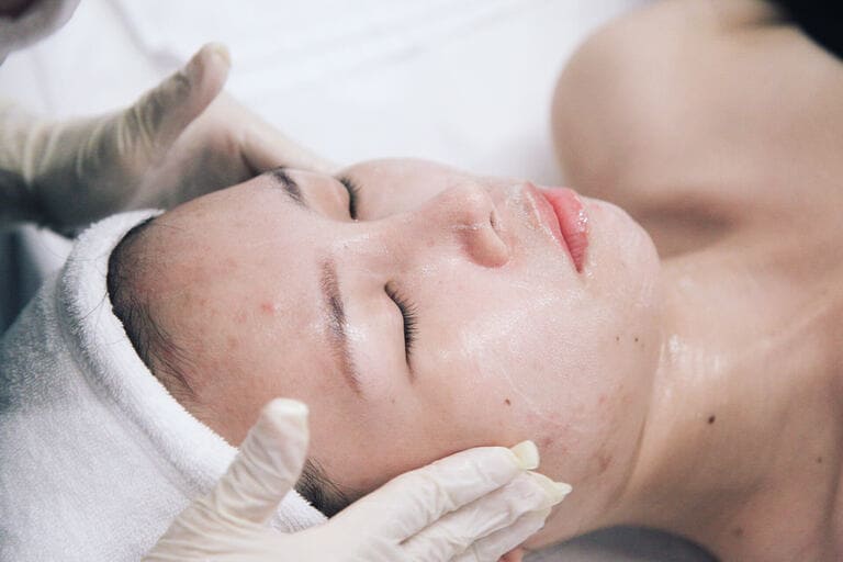 nặn mụn quận bình thạnh uy tín