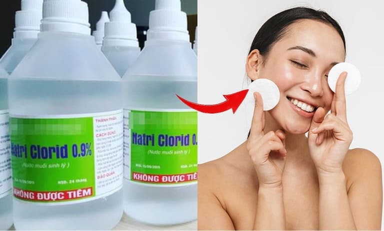 sau khi nặn mụn rửa mặt bằng nước muối
